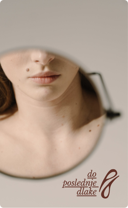 Online Konsultacije Reši Se Trajno Dlaka