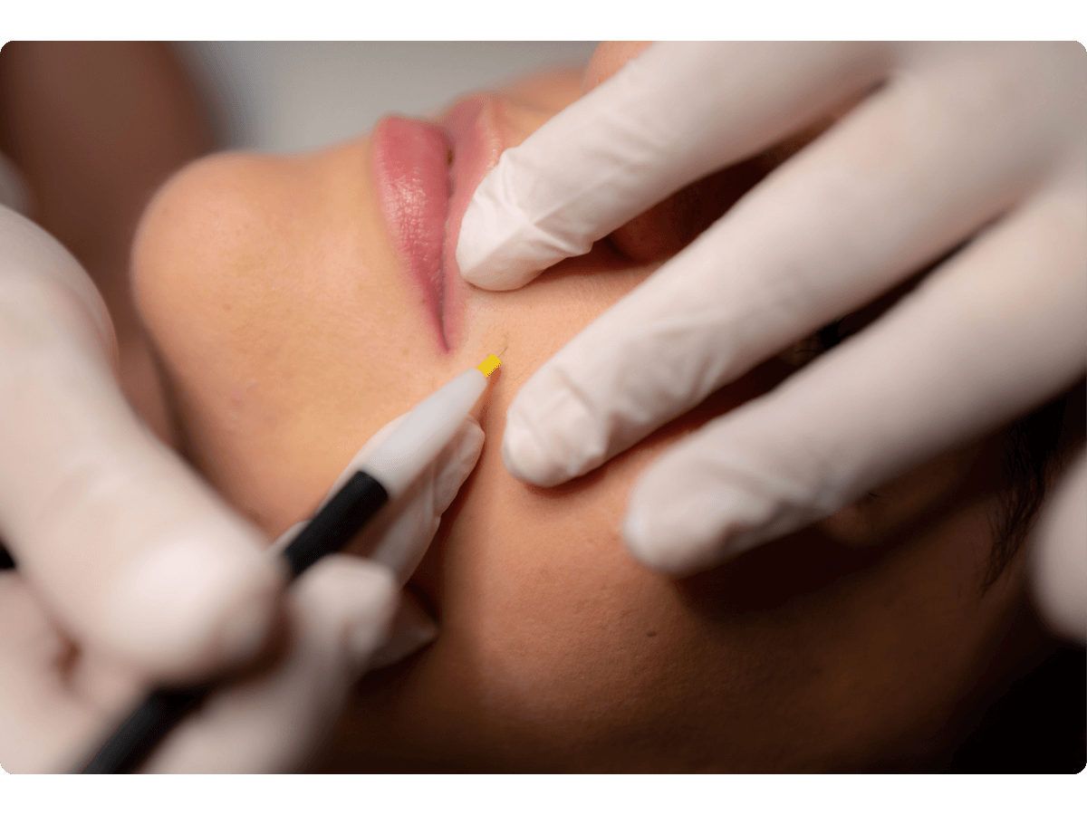 Kako Se Elektroliza Izvodi 01 (1)